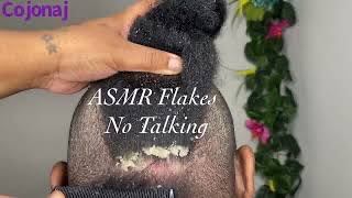 ASMR⚠️Sliding Off the Scalp⚠️ Part2 [upl. by Ayekel]