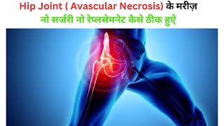 Hip Joint  के मरीज़ नो सर्जरी नो रेप्लसेमनेट कैसे ठीक हुऐ  AVN  Avascular Necrosis [upl. by Ress]