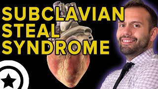 Subclavian Steal Syndrome  HIGHYIELD CARDIOLOGY  USMLE STEP 1 [upl. by Kristin]