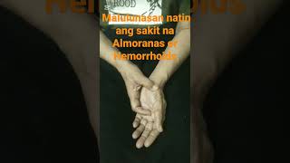 Almoranas or Hemorrhoids gagaling ito sa tulong ng Reflexology [upl. by Arathorn]