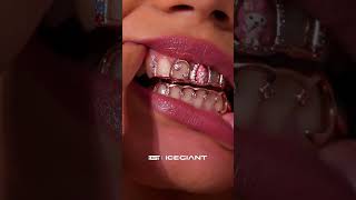 Check out our new custom grillz 😎😎 [upl. by Llydnek]