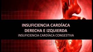 Insuficiencia cardíaca derecha e izquierda [upl. by Sonnie]