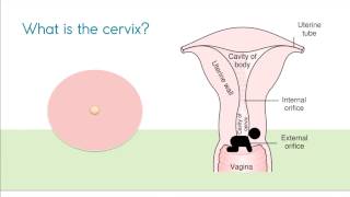 Stage 1 of Labor Cervical Dilation  Care of the Childbearing Family  Lecturio Nursing [upl. by Dwinnell]