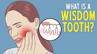 What is a wisdom tooth [upl. by Nisior644]