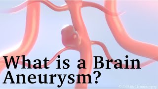 Brain Aneurysm Awareness Month  What are the Signs of a Ruptured Brain Aneurysm [upl. by Carlile312]