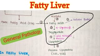 Fatty Liver  Steatosis of Liver  Fatty Change in Liver  General Pathology [upl. by Judenberg]