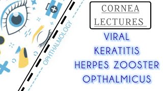 CORNEA LECTURE 10 VIRAL KERATITIS HERPES ZOOSTER OPTHALMICUS [upl. by Attirehs]