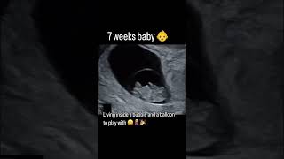 7 week ultrasound ultrasound pregnant pregnancytips [upl. by Ham]