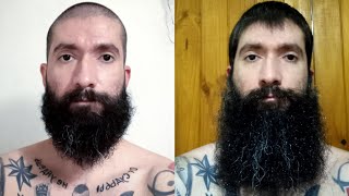 1 year beard growth timelapse [upl. by Cirenoj684]