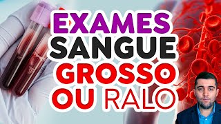 Exame de má circulação e veias entupidas como saber se tenho trombose ou embolia doppler dímero [upl. by Gonnella532]