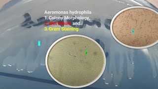 Aeromonas hydrophila Colony Morphology Wet Mount and Gram Staining [upl. by Navinod]