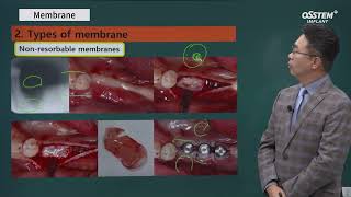 Master course SURGERY Membrane [upl. by Leonardo]