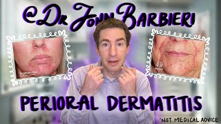 Dermatologist Explains Perioral Dermatitis How to Identify Causes amp Treatment [upl. by Ayinat591]