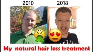 🙀 Natural hair loss treatment 14 [upl. by Maise]