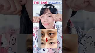 ONLY 1 EXERCISE Remove Eye Bags Permanently [upl. by Rekrap]