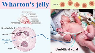 Whartons jelly [upl. by Laohcin]