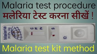 Malaria test kit method  Malaria test procedure  Malaria test kaise kiya jata hai [upl. by Roti]