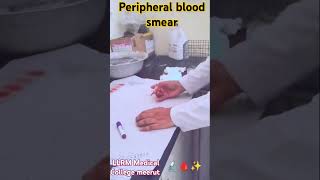 Peripheral blood smear PBS dmlt medical lab 🔬🩸✨ [upl. by Enohpets]