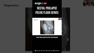 Sevent Episode of the Pelvic Floor Series Rectal Prolapse [upl. by Dlorag]