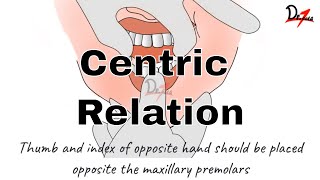 How to Determine Centric Relation PROSTHODONTICS [upl. by Htaek]