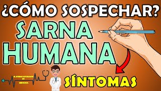 Cómo sospechar de SARNA HUMANA o ESCABIOSIS  Síntomas  El Eterno Estudiante de Medicina 📝👨🏻‍⚕️ [upl. by Judson172]