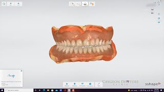 Reference Denture Intraoral Scans [upl. by Dorothi]