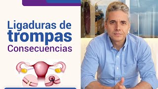 Consecuencias de la ligadura de trompas l Dr Juan Luis Giraldo [upl. by Harifaz]