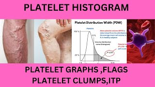 PLATELET HISTOGRAMPLATELET GRAPHPLATELET INDICESPLATELET FLAGSPLTPLT LCRPLTMP FLAGPUPL FLAG [upl. by Nywloc]