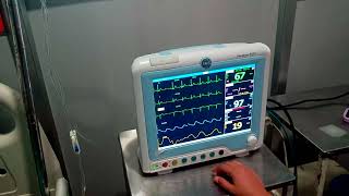 ECG lead placement in monitor ecg [upl. by Raimes]