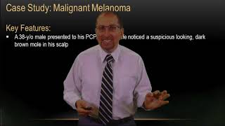 Malignant Melanoma and Case Study [upl. by Amann]