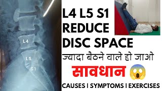 L4L5 and L5S1 reduced disc space exercises in Hindi  Disc space narrowing L5S1 treatment [upl. by Mozes]