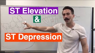 ST Elevation and ST Depression EXPLAINED [upl. by Proudlove]