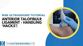 Anterior talofibular ligament  how to scan and top hacks to make it easier [upl. by Kuo519]