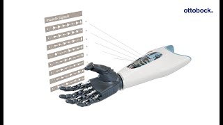 Ottobock Myo Plus pattern recognition The AI control for myoelectric arm prostheses  Ottobock [upl. by Martinson]