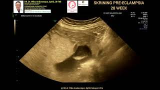 Skrining PreEclampsia 28 weeks [upl. by Al547]