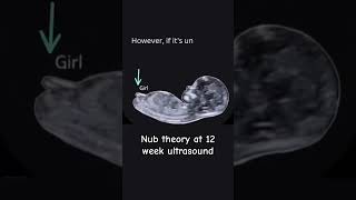 Guess the gender with Nub theory Baby boy or girl pregnancyjourney ultrasound pregnancytips [upl. by Augustine]