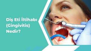 Diş Eti İltihabı Gingivitis Nedir [upl. by Mahau]