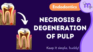 Pulp Degeneration amp Necrosis  Types  Management  Endodontics  Animated Explanation [upl. by Fulbert]