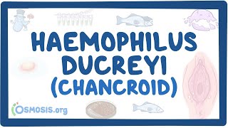 Haemophilus ducreyi Chancroid  an Osmosis Preview [upl. by Lenny466]