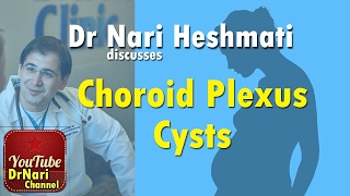 CPC Choroid Plexus Cysts on Ultrasound in Pregnancy Discussed by Dr Nari Heshmati [upl. by Yecart]