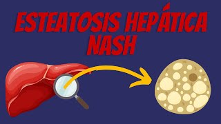 Esteatosis Hepática  NASH  MASLD [upl. by Lam]