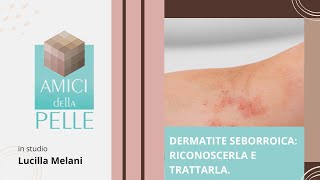 Dermatite seborroica riconoscerla e trattarla [upl. by Hgiellek655]