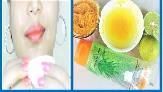 How to Aloe Vera Gel uses for Rid of ACNE  Remove ACNE and get Fair Bright Skin in Hindi [upl. by Ociredef]