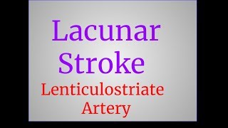 Lacunar Stroke [upl. by Earal]