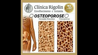 OSSOS POROSOS  OSTEOPOROSE [upl. by Graniah422]