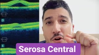 Me recuperei da Serosa Central [upl. by Angadreme42]