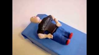 DixHallpike and Epley Maneuvers for BPPV in Claymation [upl. by Maggio554]