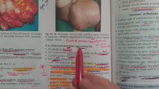 Phyllodes tumor  Cystosarcoma Phyllode in hindi [upl. by Oijres]