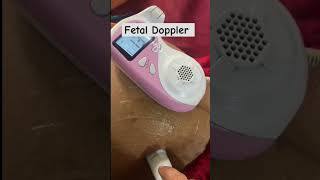 Fetal Doppler babyvideobaby [upl. by Crane438]