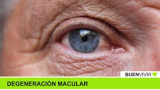 DEGENERACIÓN MACULAR  Consultorio Nítido  BUENVIVIR💚 071024 Canal 4 [upl. by Link]